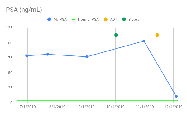 Prostate Cancer PSA Prostatitis